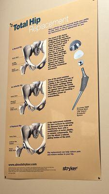 Reconstructive Orthopedics