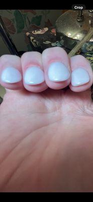 Cut, inflamed skin around my nails