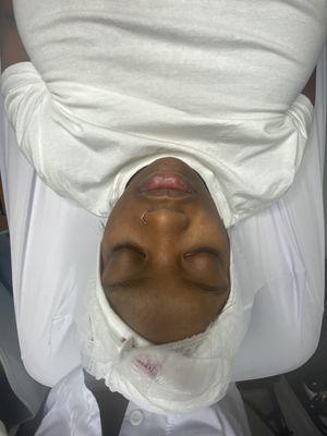 Before, 1hr Hydrofacial treatment.