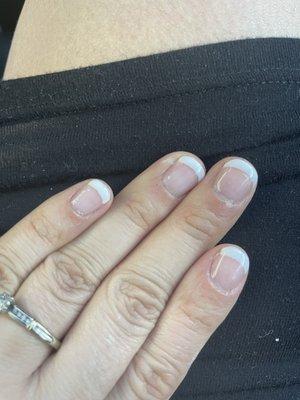 Messy, burned fingers by applying shellac to skin