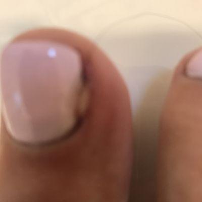 Pedi results