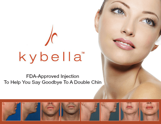 Exclusive treatment by TBA; a treatment for adults with moderate-to-severe fat below the chin, known as submental fat.