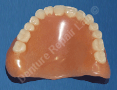 Tooth repaired on upper denture