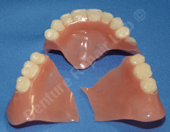 Broken denture