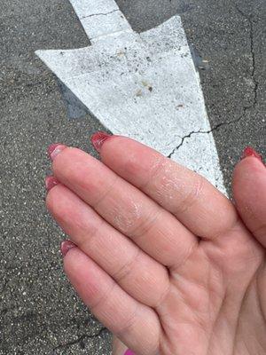 Acrylic cakes on my fingers and you can see the one fingernail that's separated.