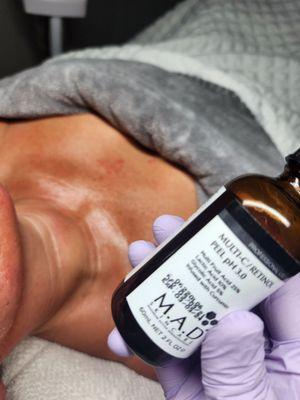 Retinol C skin Tightening Treatment for Neck & Décolleté