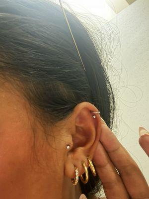 Second helix and tragus