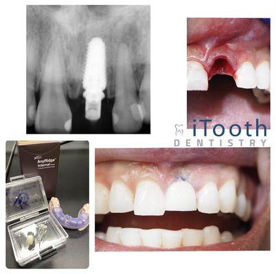 iTooth Dentistry