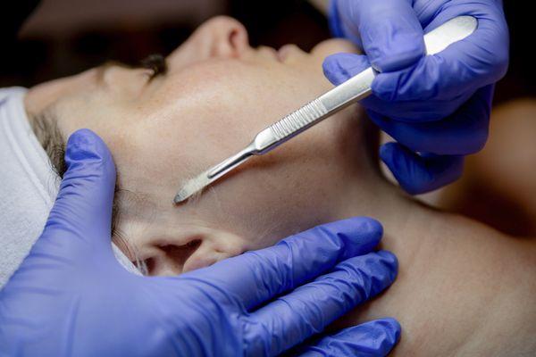 Removing dead skin and pesky peach fuzz with dermaplaning.