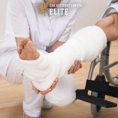 Leg injuries are common in car accidents. Contact our law office today!