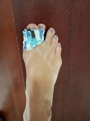 The toe that broke from the piece of cabinet falling on my friend's foot.  Lucky the screw didn't stab her.