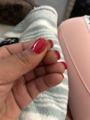 Nail not installed properly