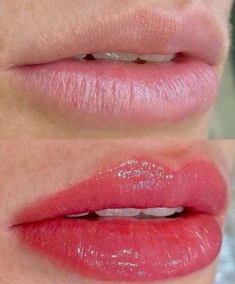 Hydro lips  enhancement with color