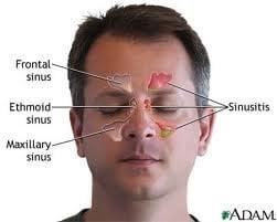 Sinuses diagram. Location of paranasal sinuses.