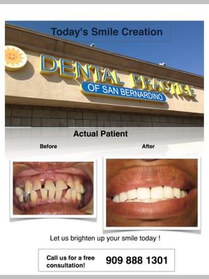 Actual Patient Case! We offer all types of dental services including implants, dentures, and crowns!