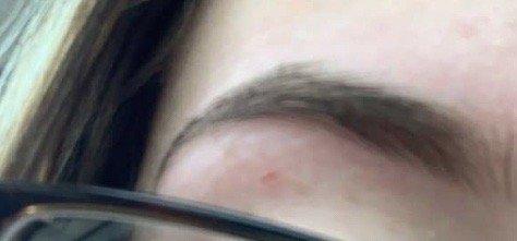 Left cut eyebrow after threading