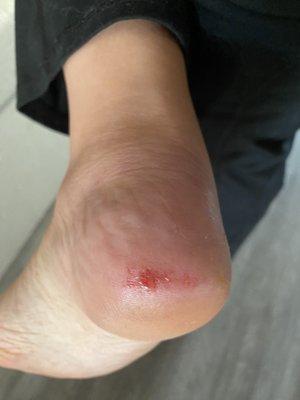 This is my heel after a pedicure.