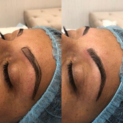 Eyebrow Microblding