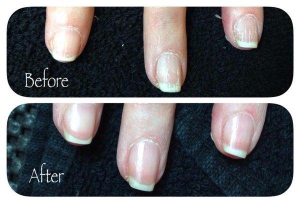 IBX treatments stunning results! The only permanent strengthening and repair treatment.