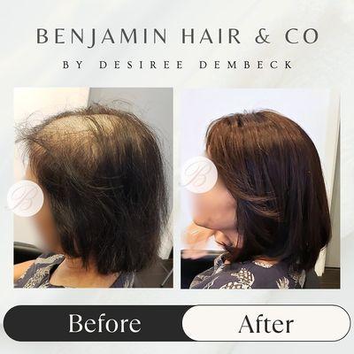 Custom Hair Toppers at Benjamin Hair & Co. Styled and colored to perfection, our hair toppers and wigs are ideal for those facing Alopecia,