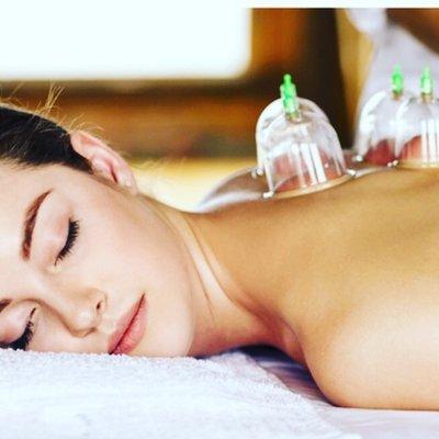 Cupping therapy