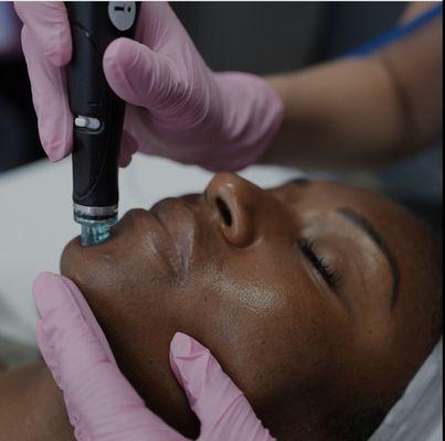 Hydrafacial