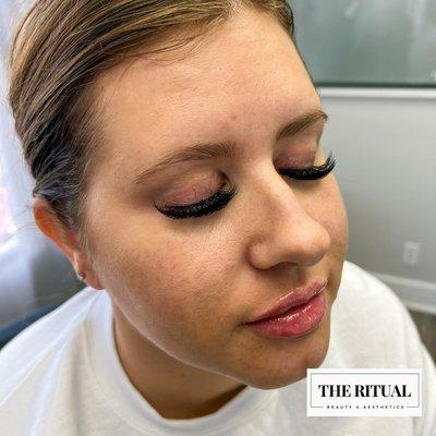 Volume eyelash extensions & lip filler