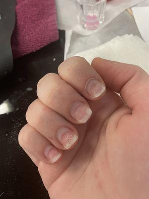 Damaged Nails