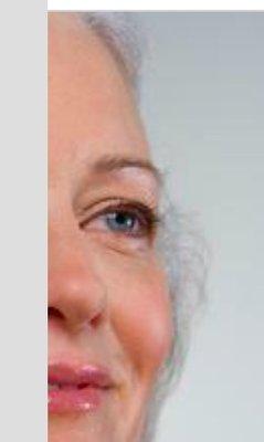 Removal of wirey gray hair on sides of face near hairline