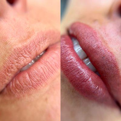 Before and after lip blush