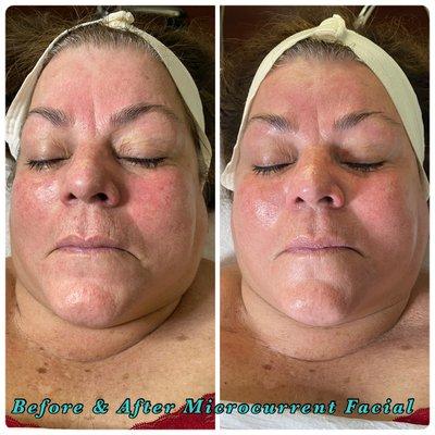 Before & After same day Microcurrent Facial!