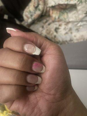 Broken nail visibly thinner than the others