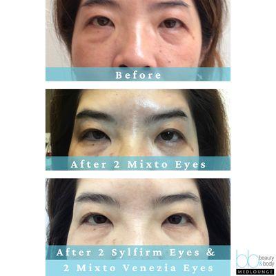 Mixto and SylfirmX for the best results!