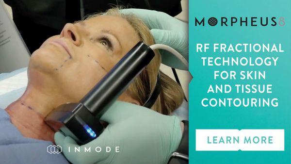 Microneedling and skin tight, new collagen growth, skin looks younger