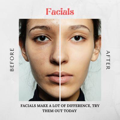 Facials make a lot of difference, try them out today