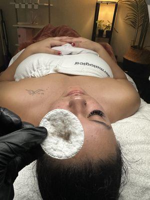 Dermaplane facial