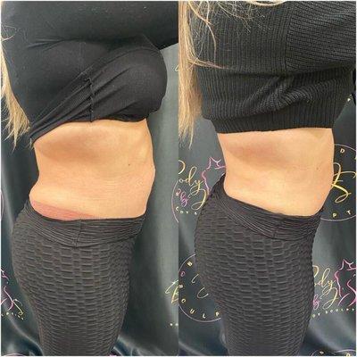 Body sculpting- contour your body and lose inches per session. $75 a session