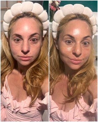 Before and after facial!