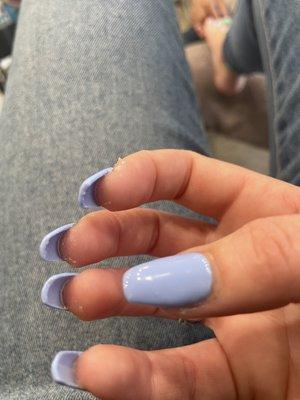 Bad nails