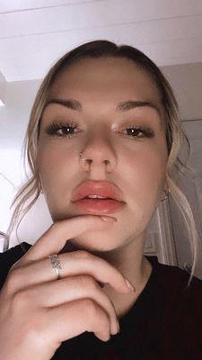 Lip injections by Dr. park is a must. Look how perfect her work is.