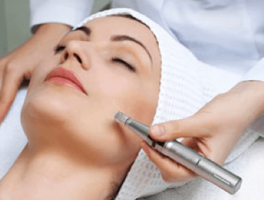 Microneedling