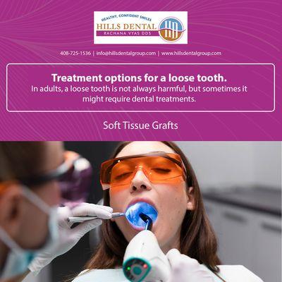 #dentalcare #dentalprocedures #HillsDentalGroup #RachanaVyas #Dentalcaresanjose #loosetooth #dentaltreatments #dental #dentist