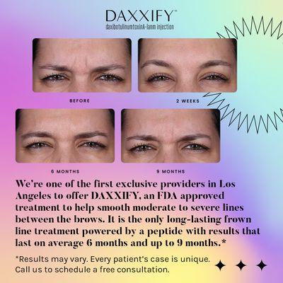 We're one of the first exclusive providers in Los Angeles to offer DAXXIFY, an FDA-approved, longer lasting frown line treatment.