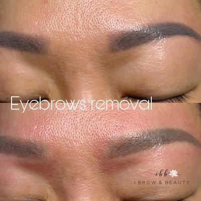 Eyebrows color removal
 Powder Brows semi permanent make up