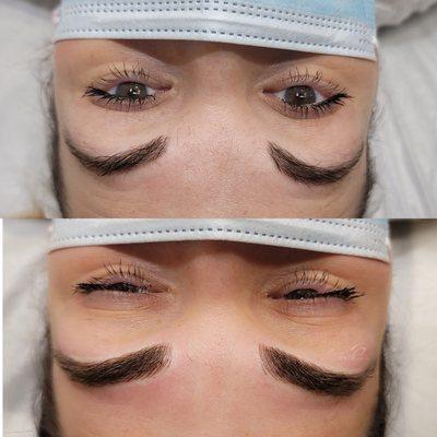 Brow shape correction and expansion with microblading