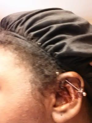 9/15/14 my ear gushed blood almost 2 months after getting my piercing