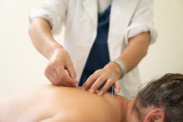 Lan He treating a patient with acupuncture