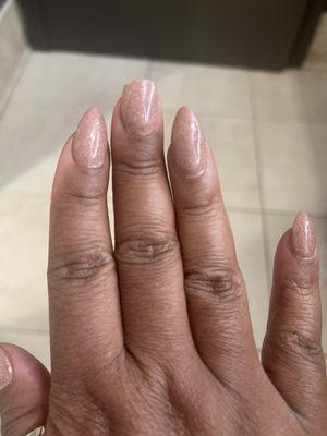 Thick, uneven, look at the cuticles