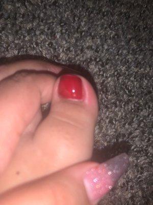 Swallow toe