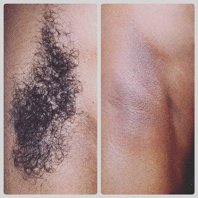 Underarm Wax